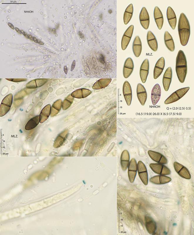 macrostoma