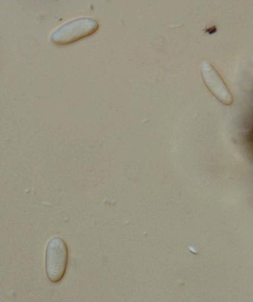 macrostoma
