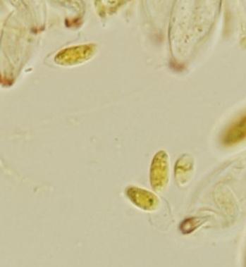 macrostoma