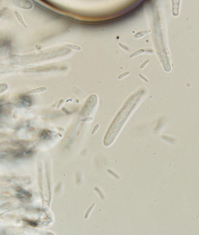 macrostoma