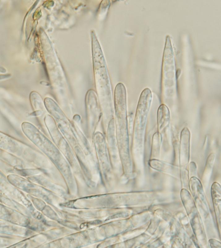 macrostoma