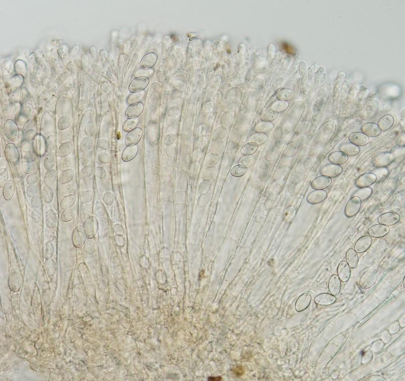 macrostoma