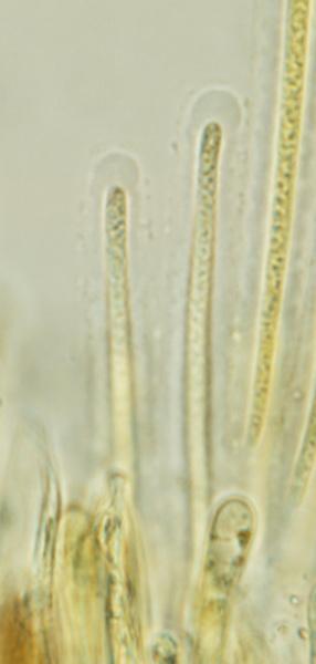 macrostoma