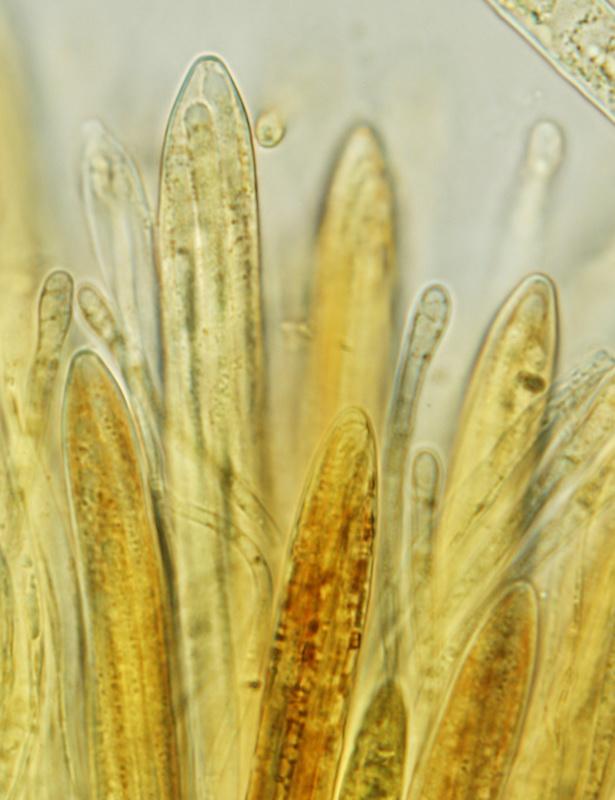 macrostoma
