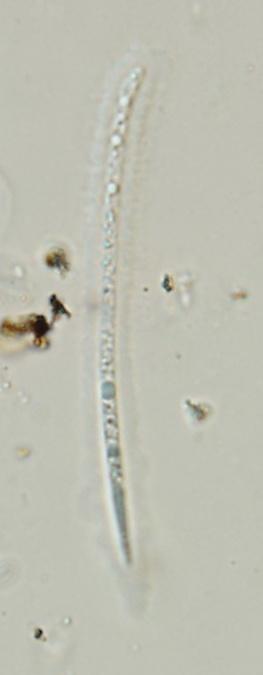 macrostoma