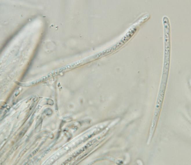 macrostoma