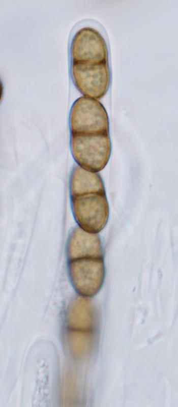 macrostoma