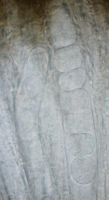 macrostoma