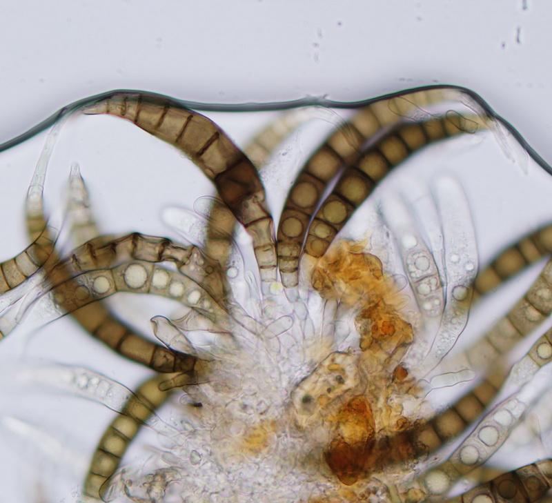 macrostoma