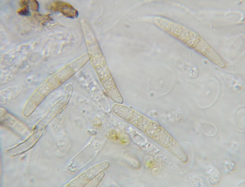 macrostoma