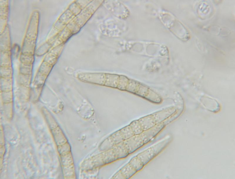 macrostoma