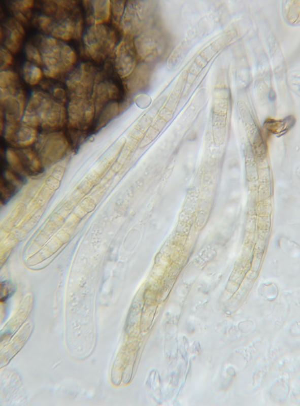 macrostoma