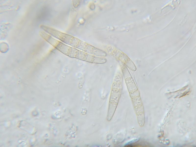 macrostoma