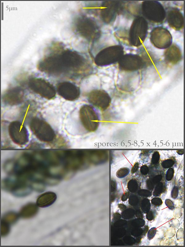 macrostoma