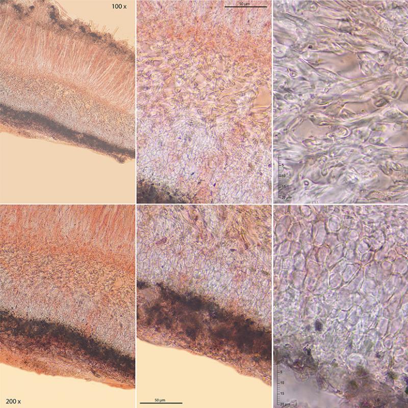 macrostoma
