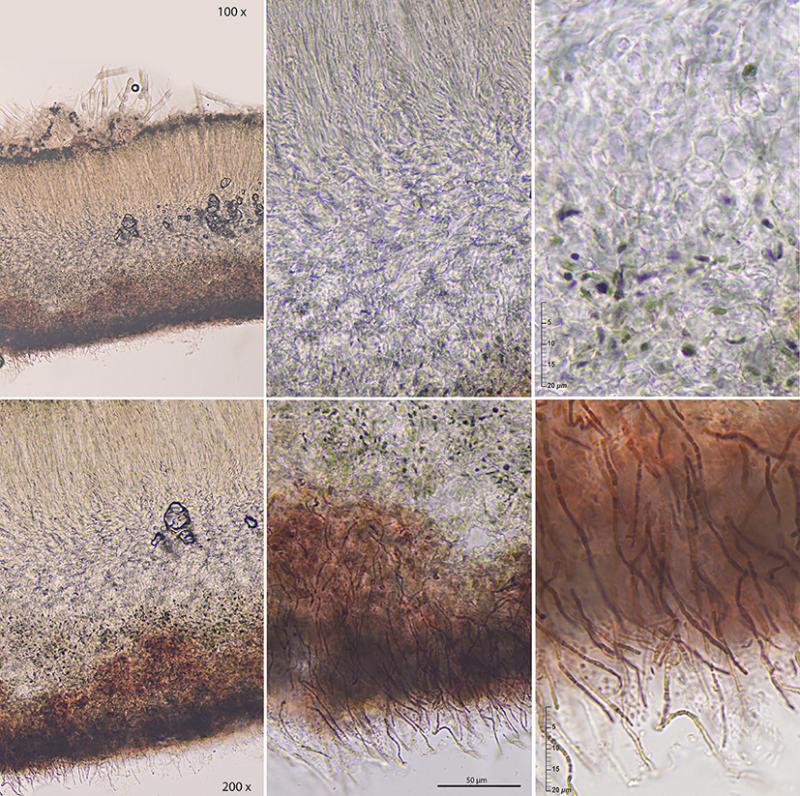 macrostoma