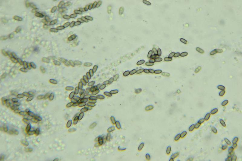 macrostoma