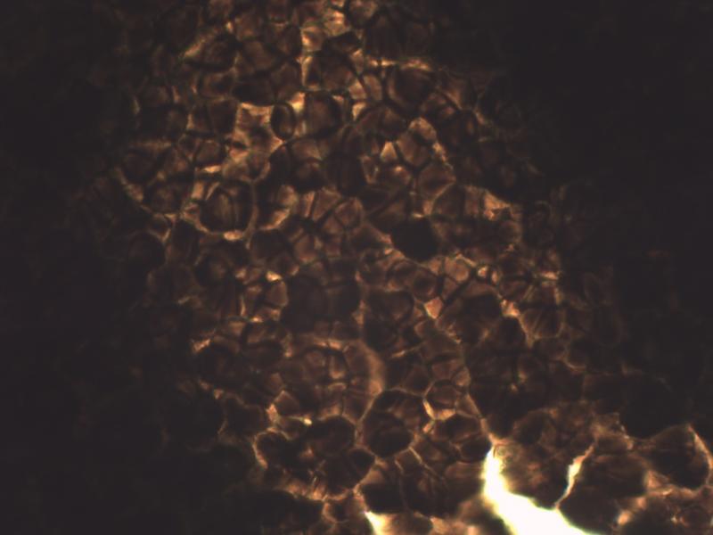 macrostoma