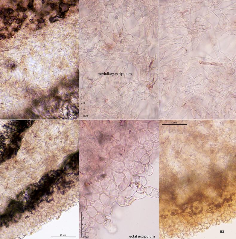 macrostoma