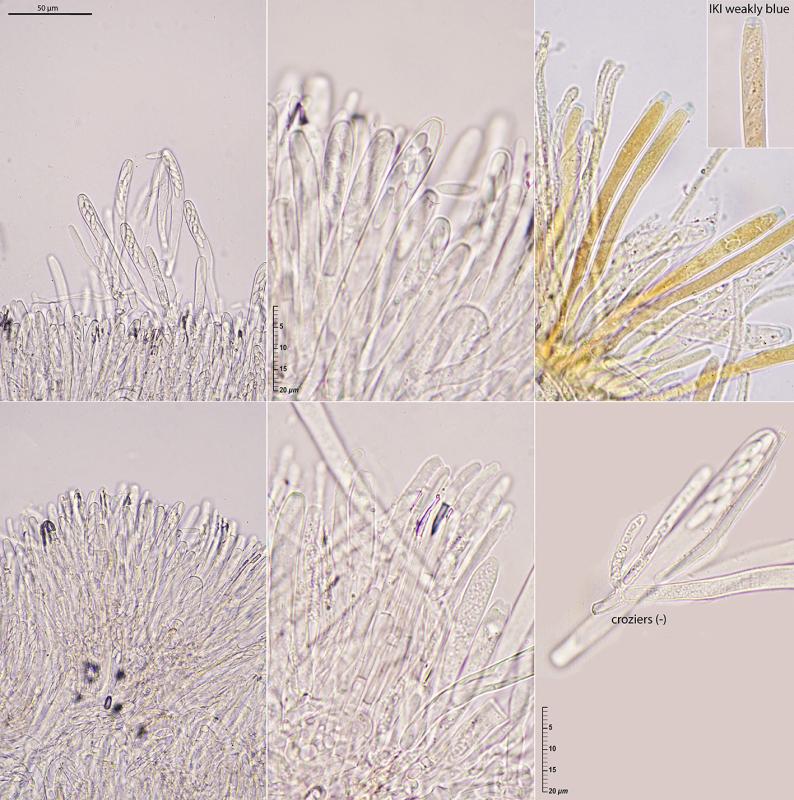 macrostoma