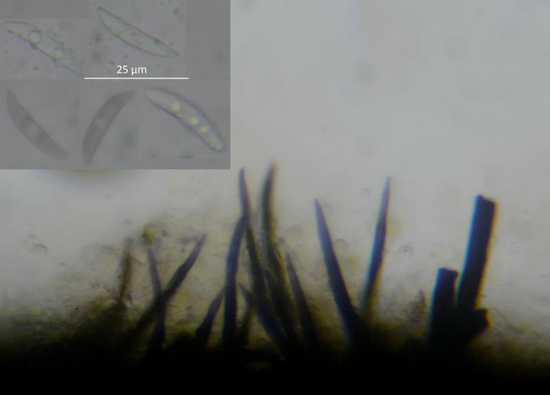 macrostoma