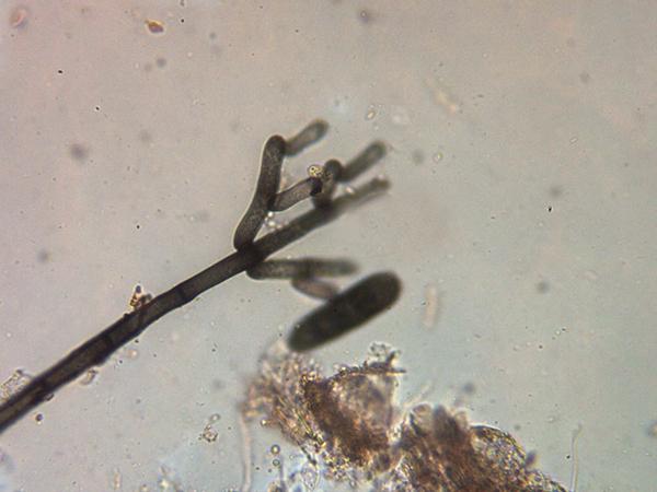 macrostoma