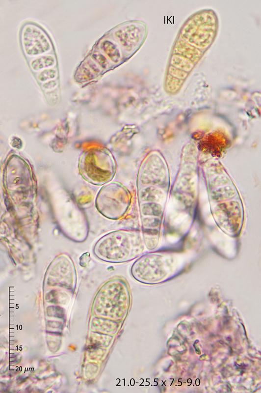 macrostoma