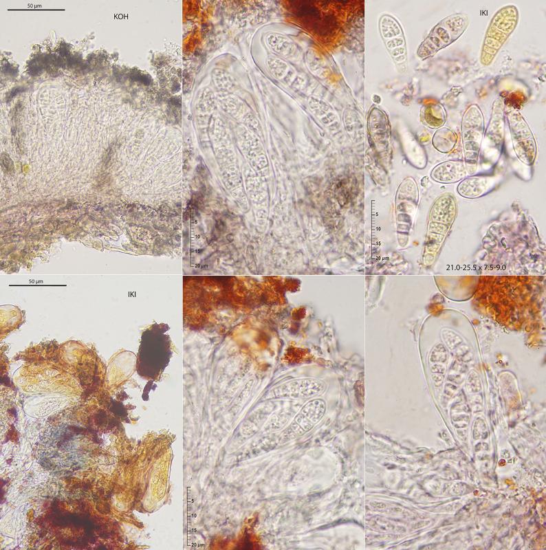 macrostoma