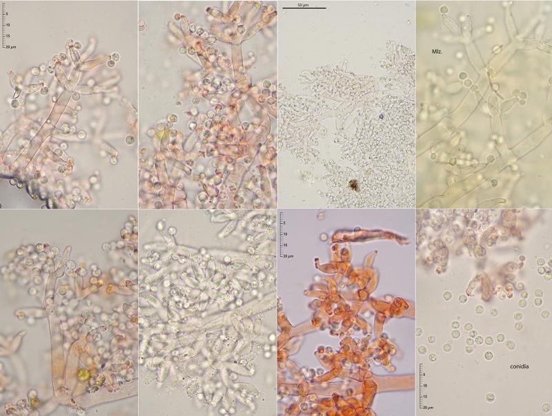 macrostoma