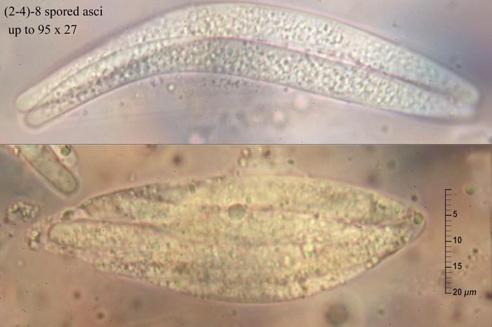 macrostoma