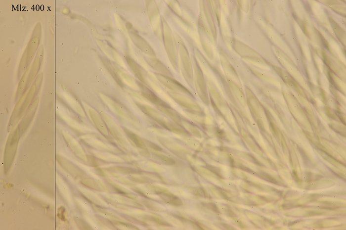macrostoma