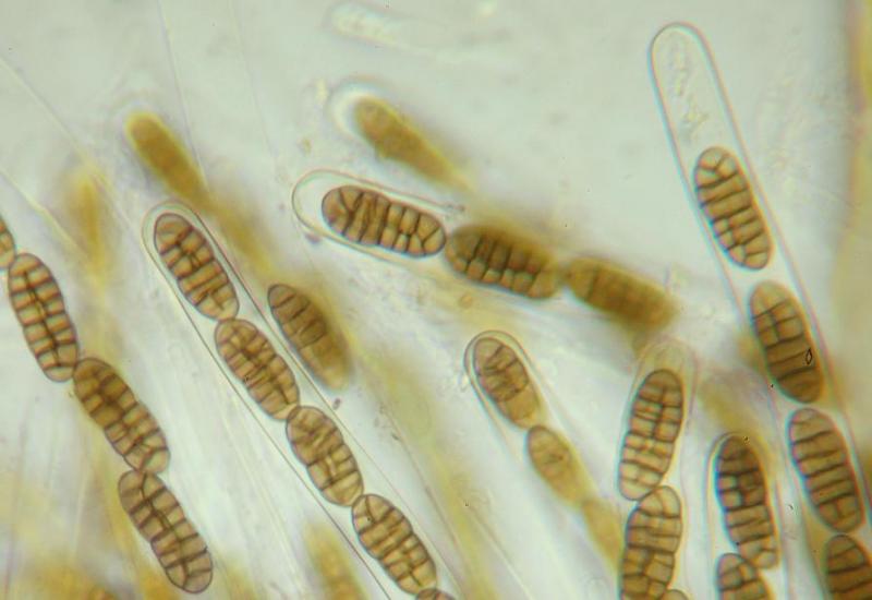 macrostoma