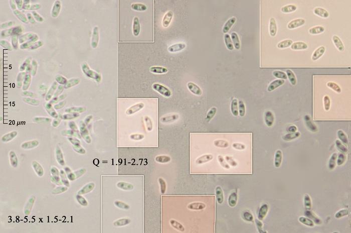 macrostoma