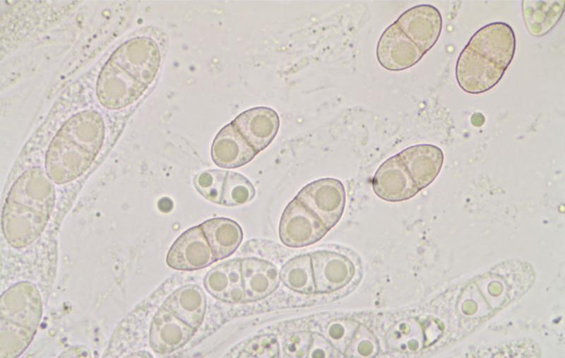 macrostoma