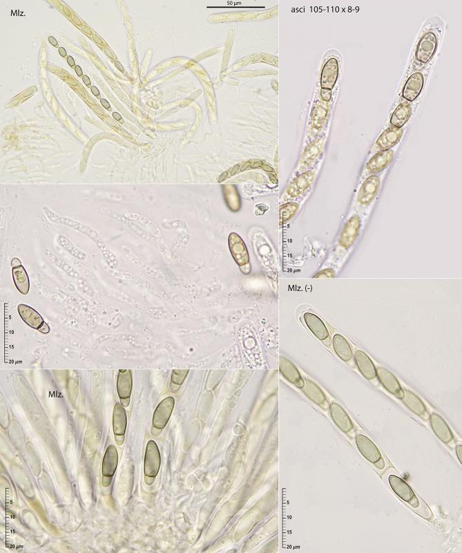 macrostoma