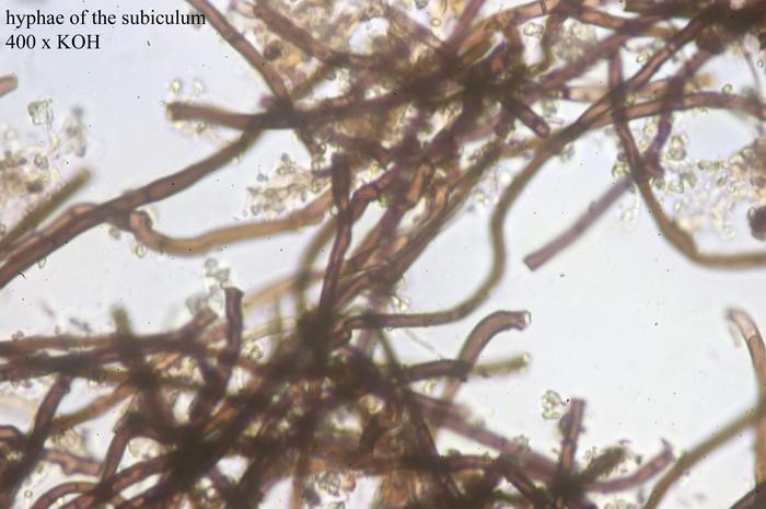macrostoma
