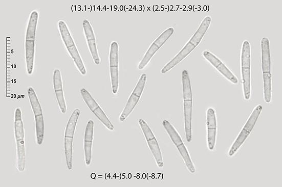 macrostoma