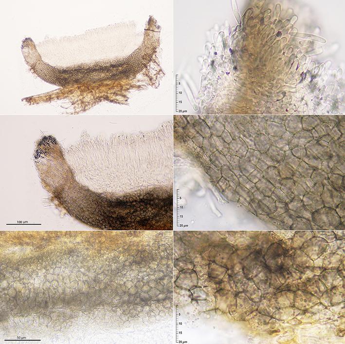 macrostoma