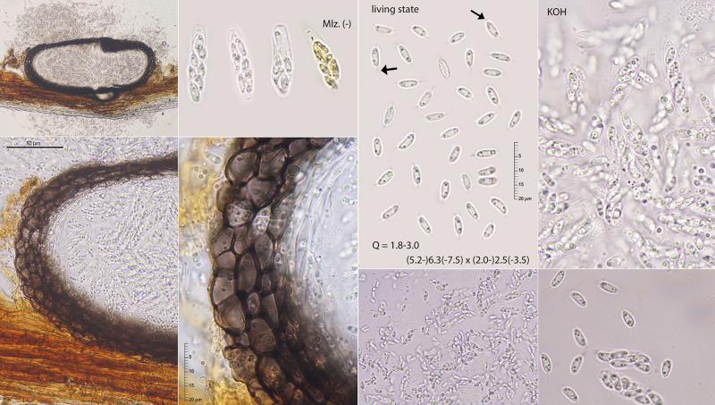 macrostoma