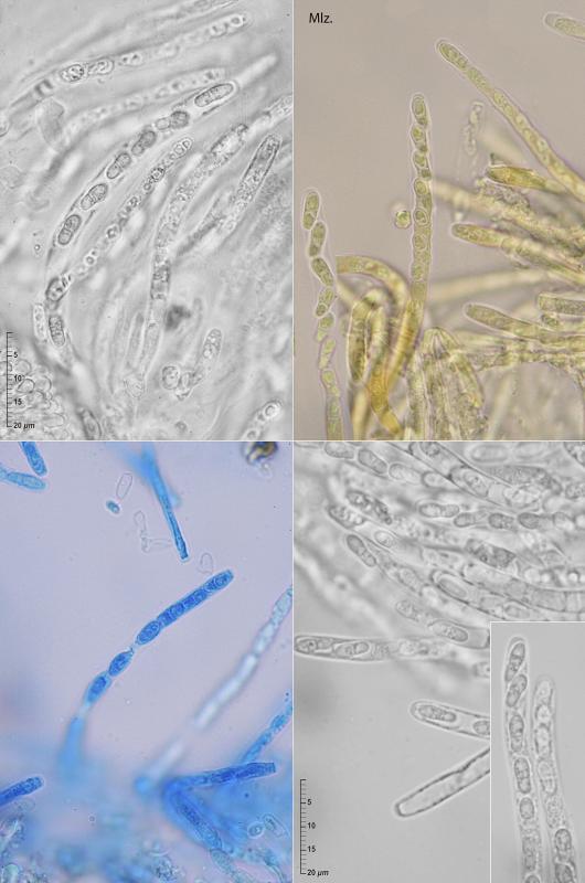 macrostoma