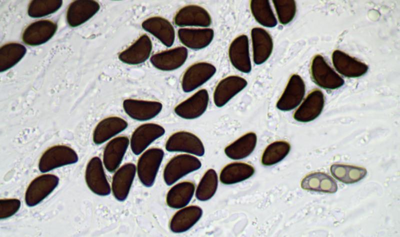 macrostoma