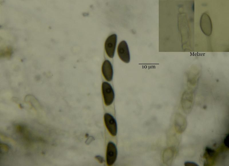 macrostoma