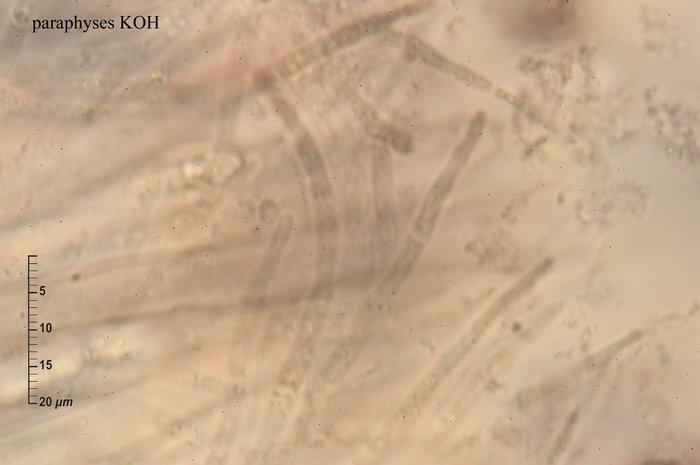 macrostoma