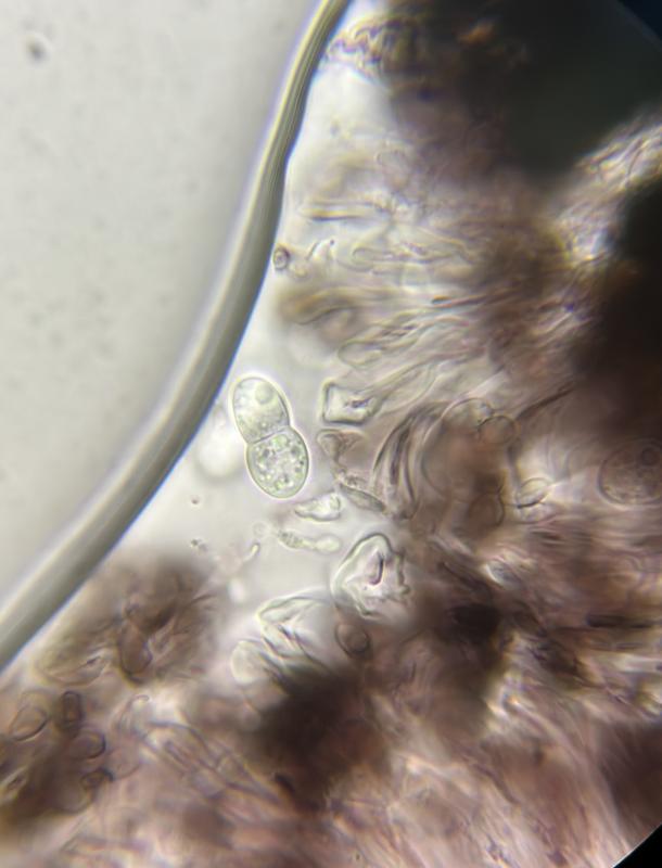 macrostoma