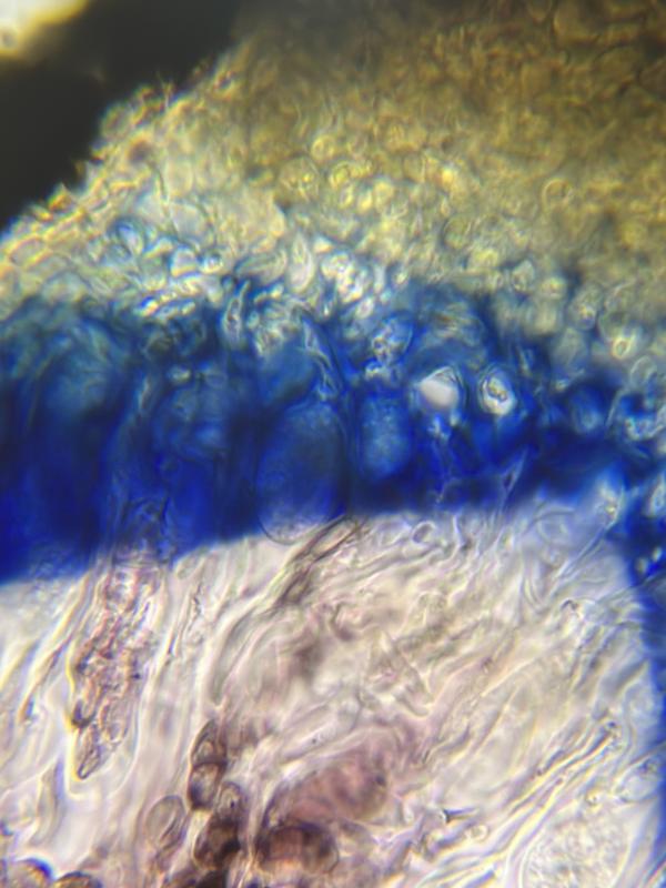 macrostoma