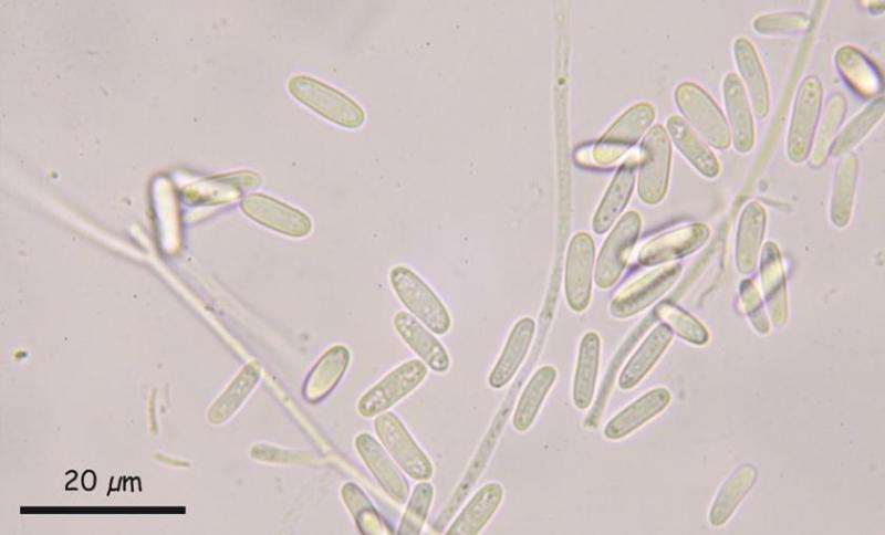 macrostoma