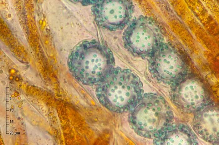 macrostoma