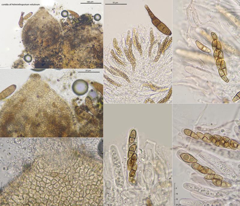 macrostoma
