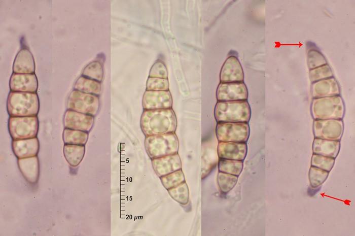 macrostoma