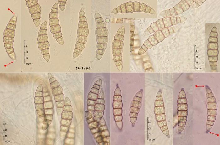 macrostoma